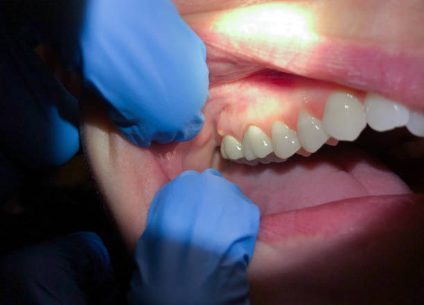Best Emergency Cosmetic Dentistry (e.g., broken veneers) in Charlotte, NC